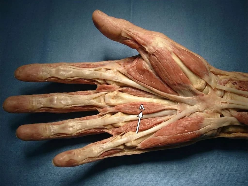 Clinical image for NEET PG 2018 Q9