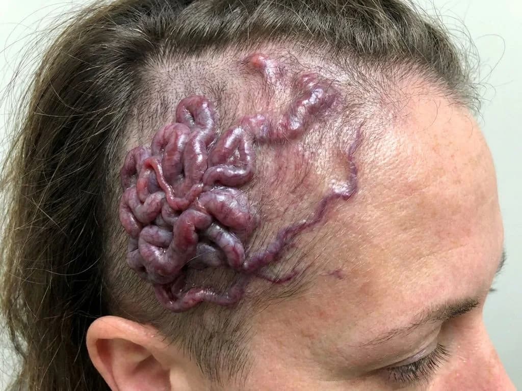Clinical image for NEET PG 2020 Q222