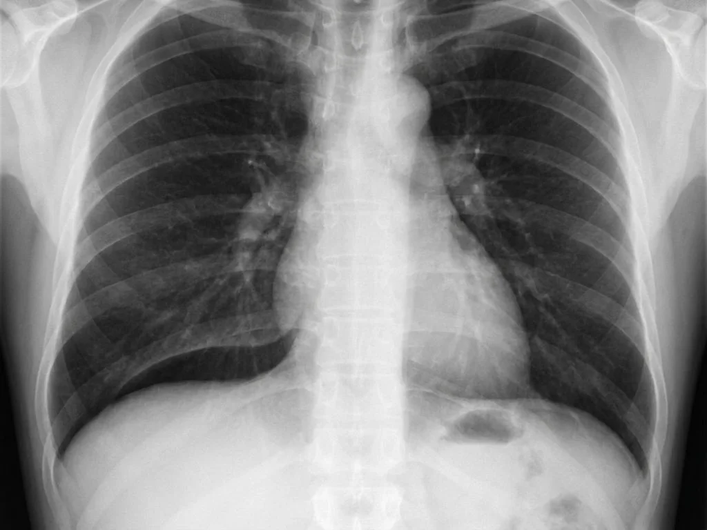 Clinical image for NEET PG 2022 Q161