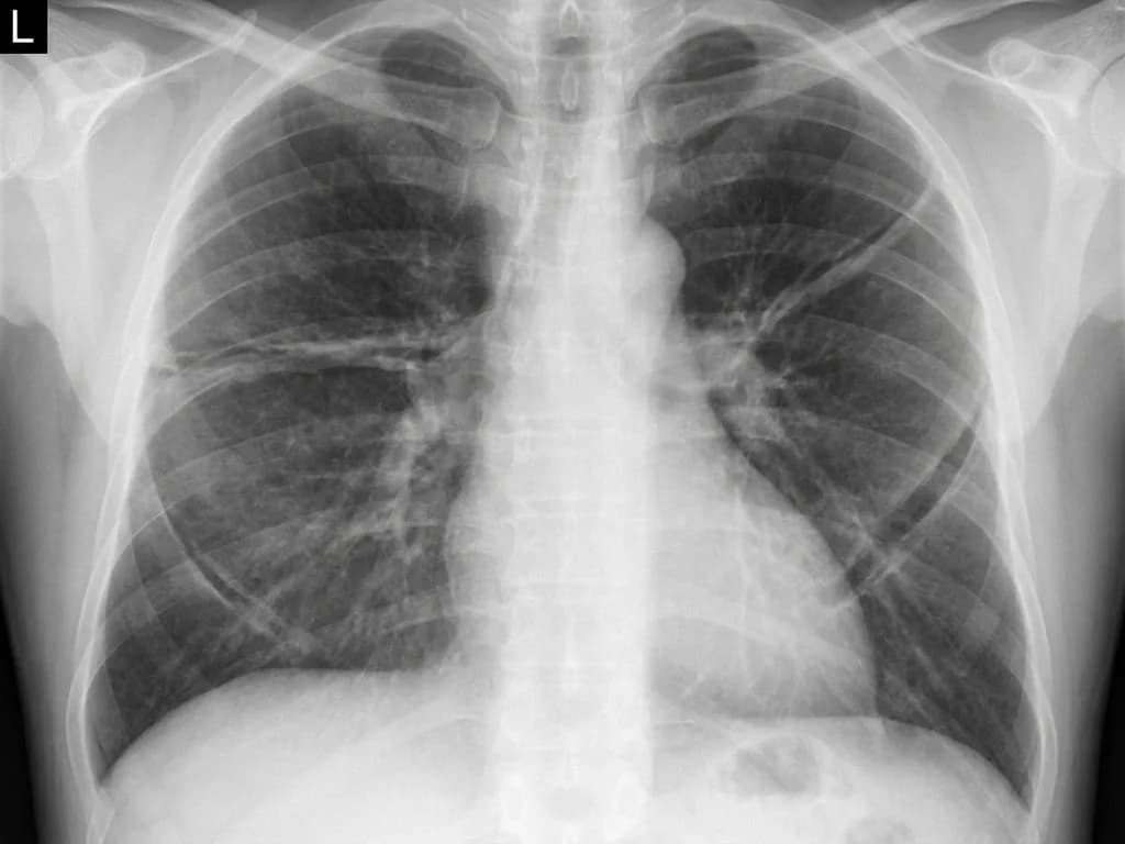 Clinical image for NEET PG 2023 Q191