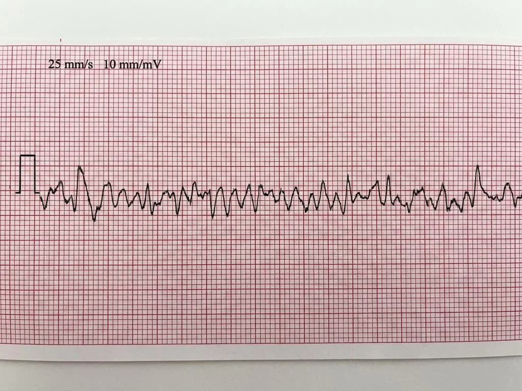 Clinical image for NEET PG 2024 Q2