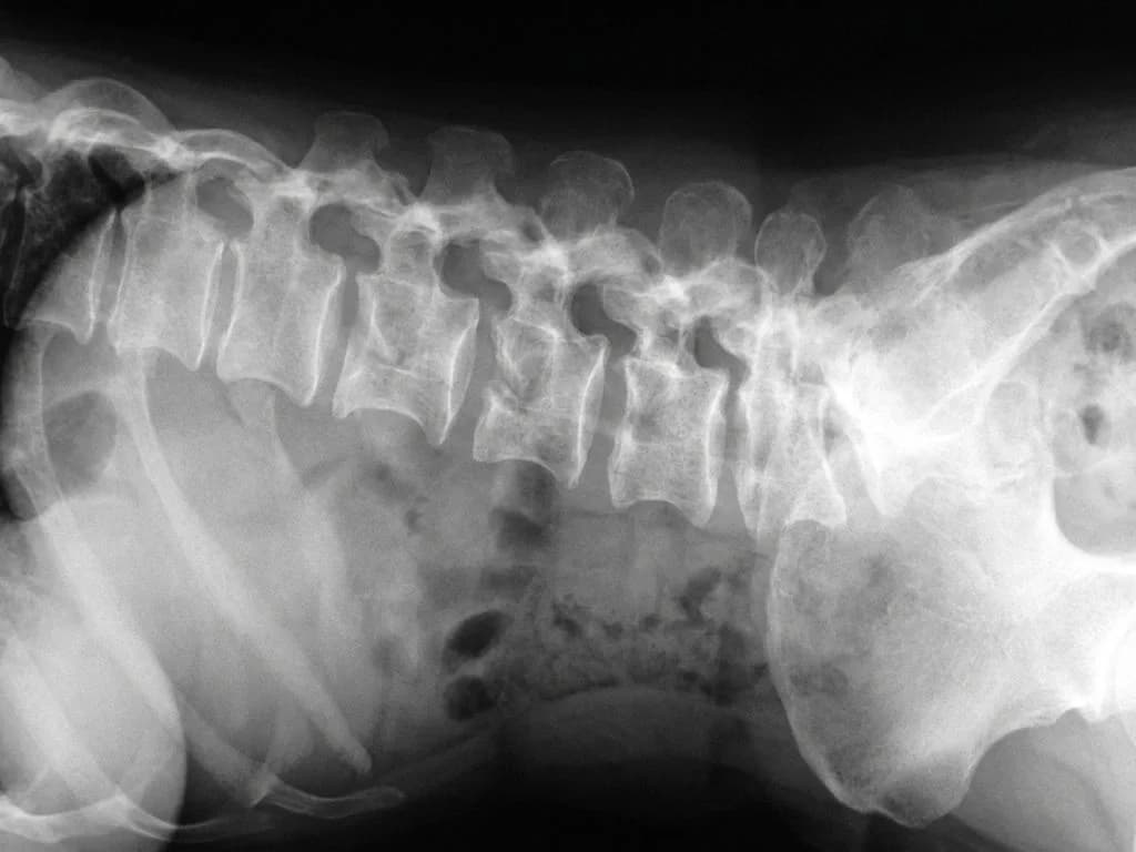 Clinical image for NEET PG 2020 Q226