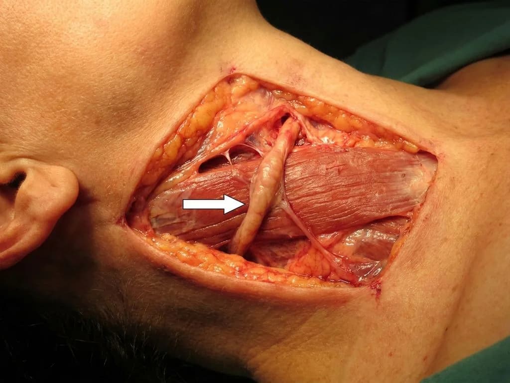 Clinical image for NEET PG 2018 Q1