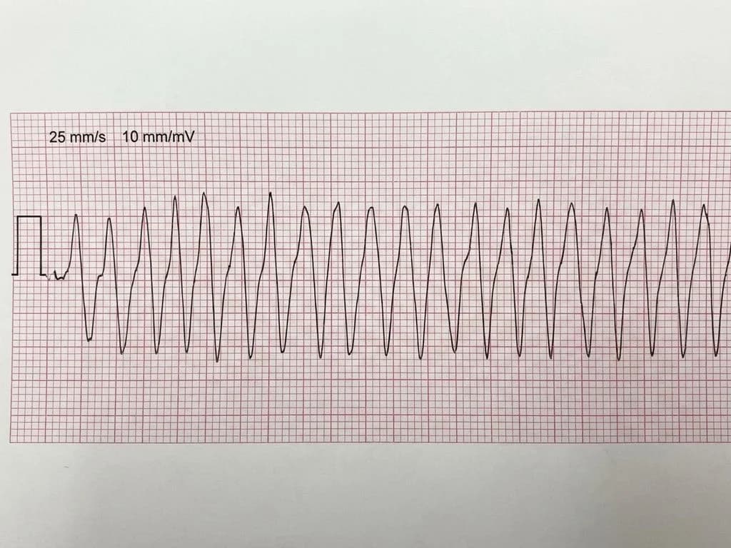 Clinical image for NEET PG 2019 Q298