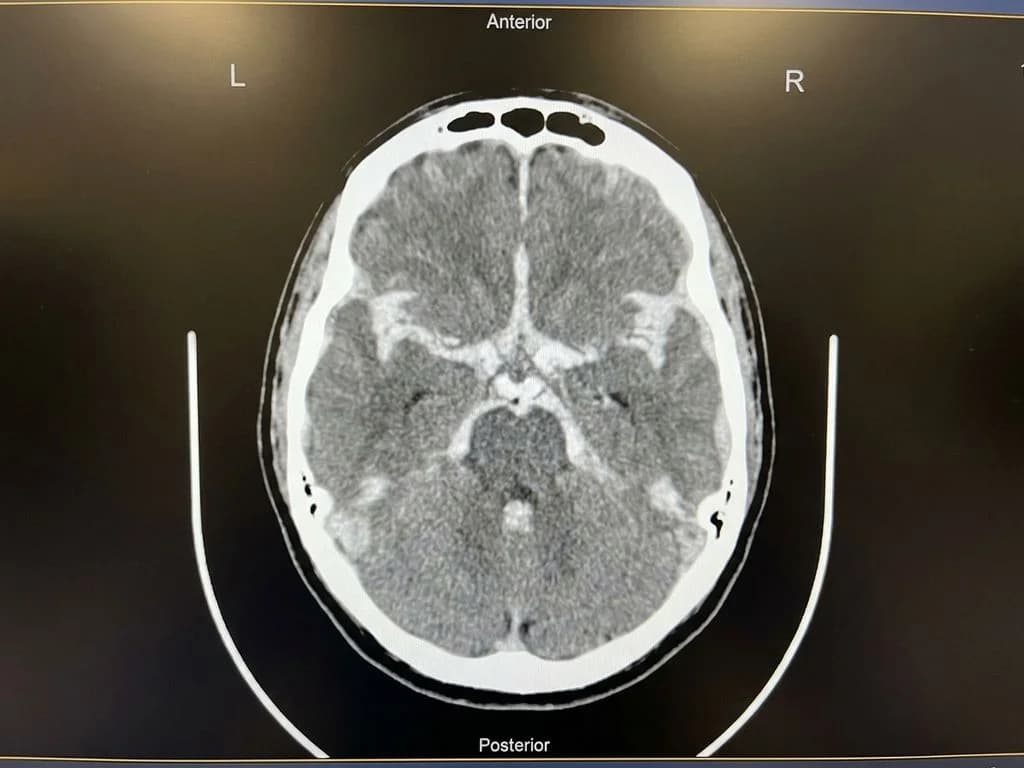Clinical image for NEET PG 2020 Q195