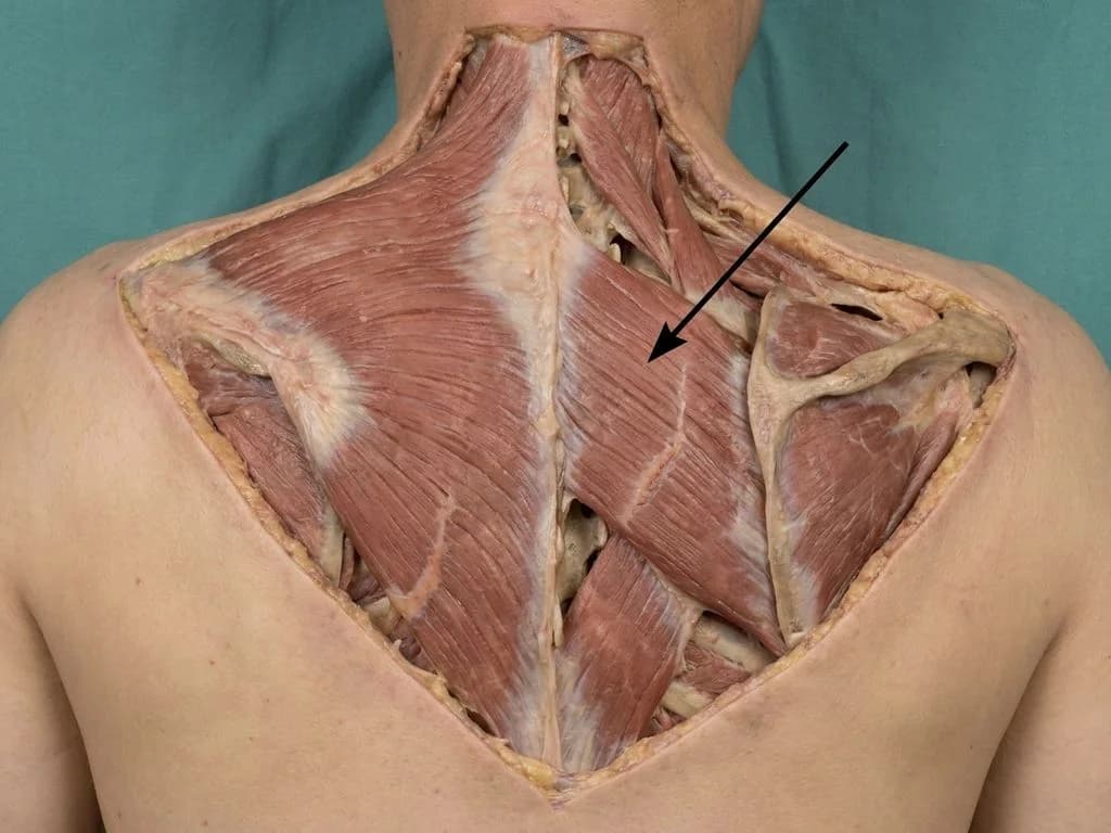 Clinical image for NEET PG 2020 Q234