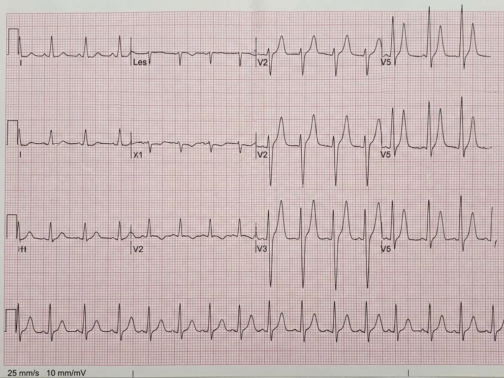 Clinical image for NEET PG 2021 Q111