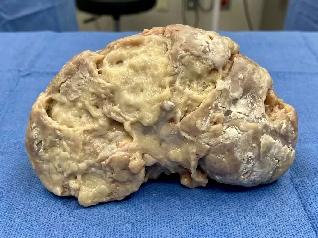 Clinical image for NEET PG 2021 Q200