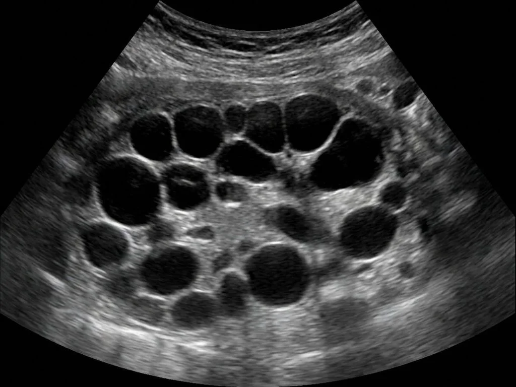 Clinical image for NEET PG 2022 Q160