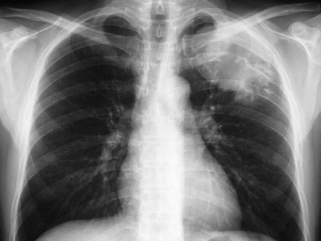 Clinical image for NEET PG 2023 Q137