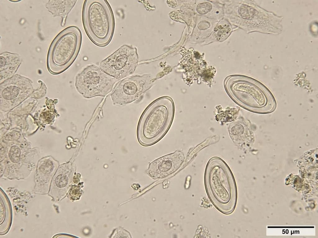 Clinical image for NEET PG 2024 Q20