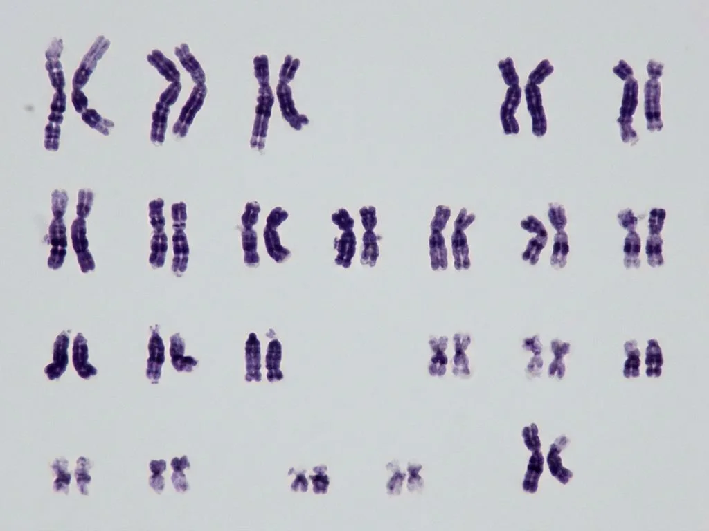 Clinical image for NEET PG 2024 Q26