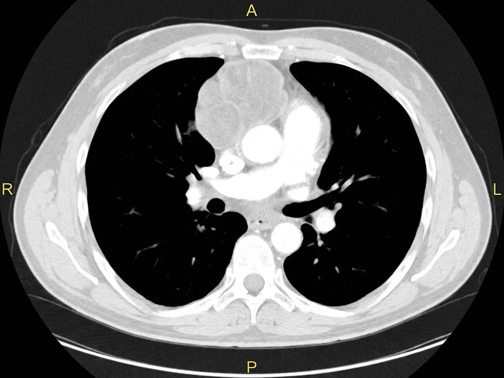 Clinical image for NEET PG 2024 Q38
