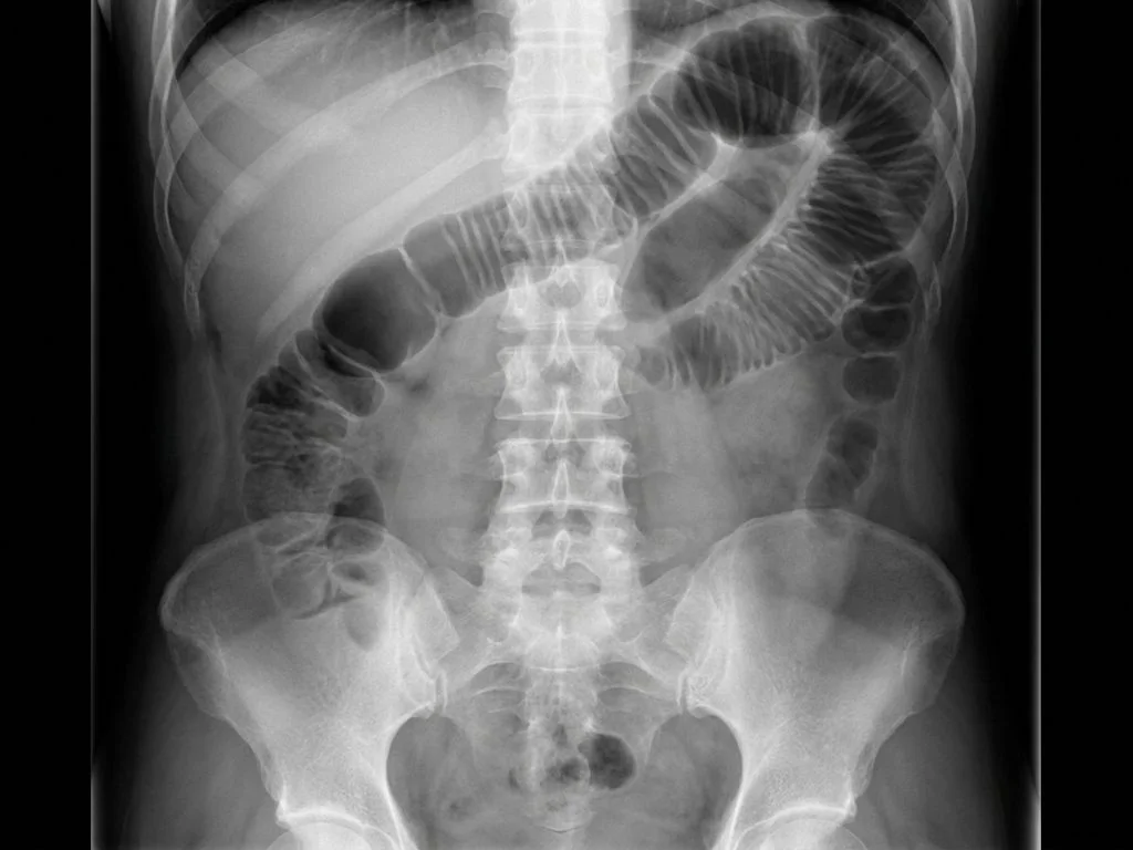 Clinical image for NEET PG 2021 Q185