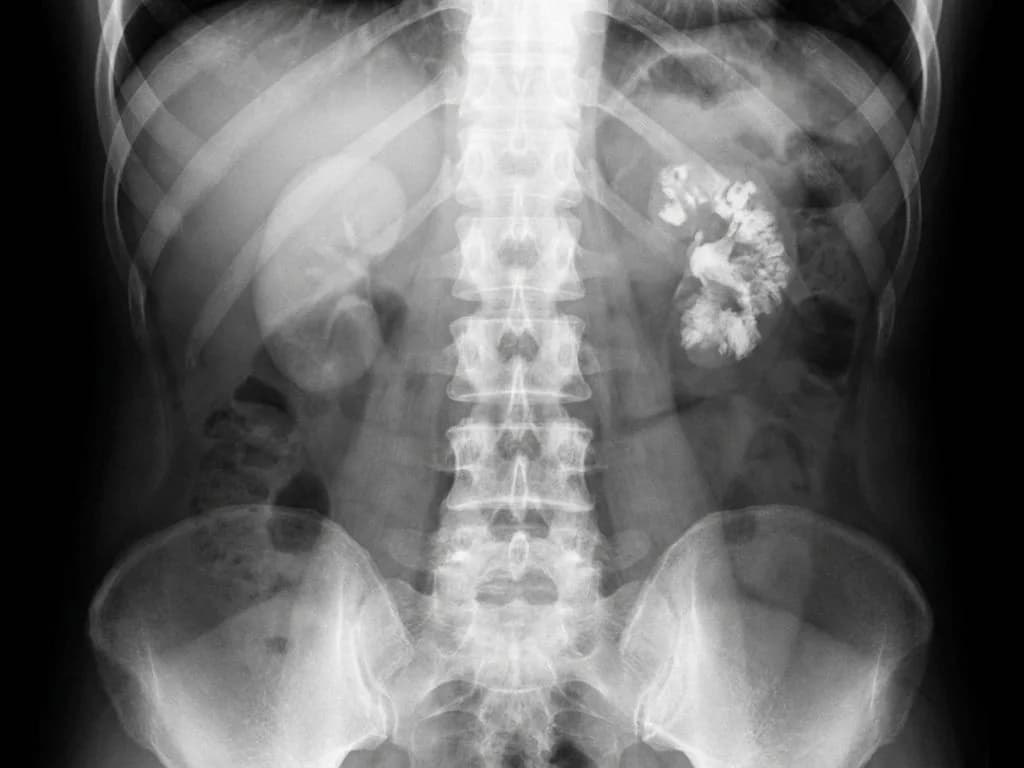 Clinical image for NEET PG 2023 Q13