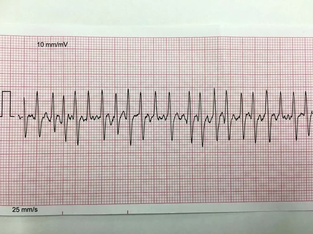 Clinical image for NEET PG 2023 Q98