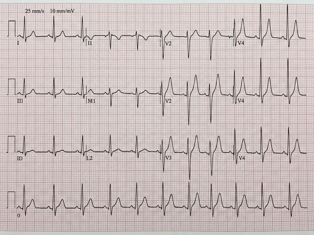 Clinical image for NEET PG 2023 Q134