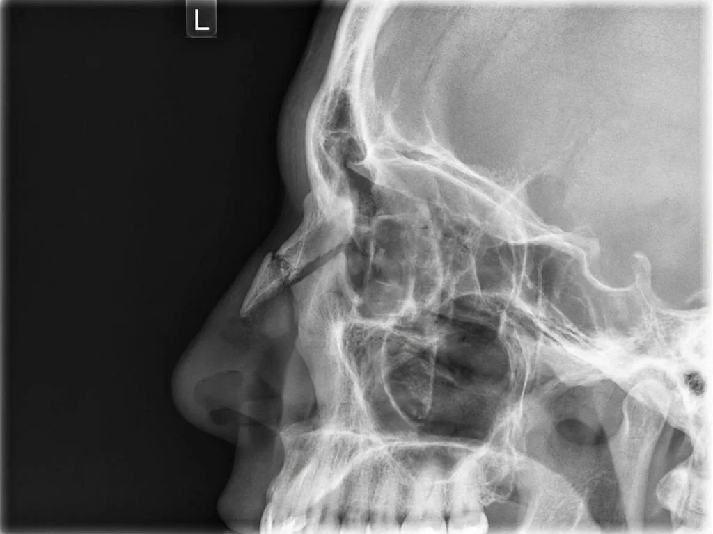 Clinical image for NEET PG 2025 Q50