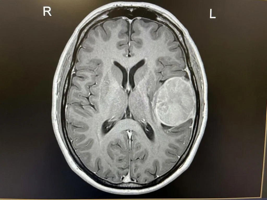 Clinical image for NEET PG 2025 Q125