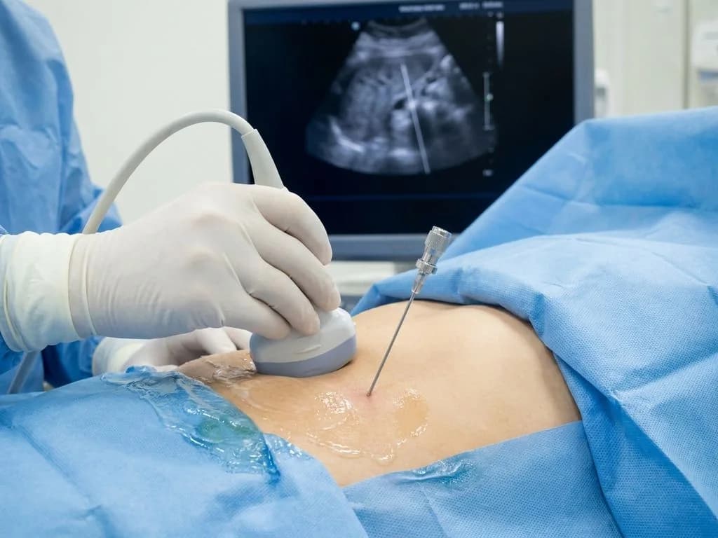 Clinical image for NEET PG 2025 Q127