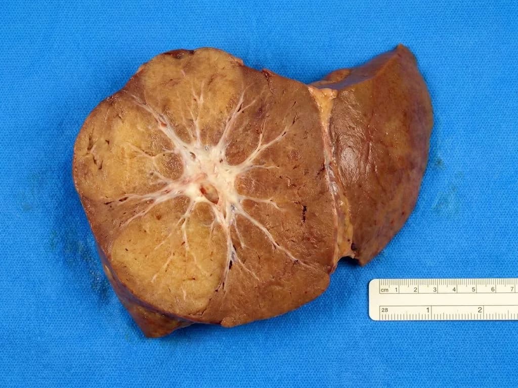 Clinical image for NEET PG 2025 Q135
