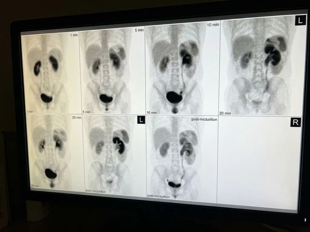 Clinical image for NEET PG 2025 Q183